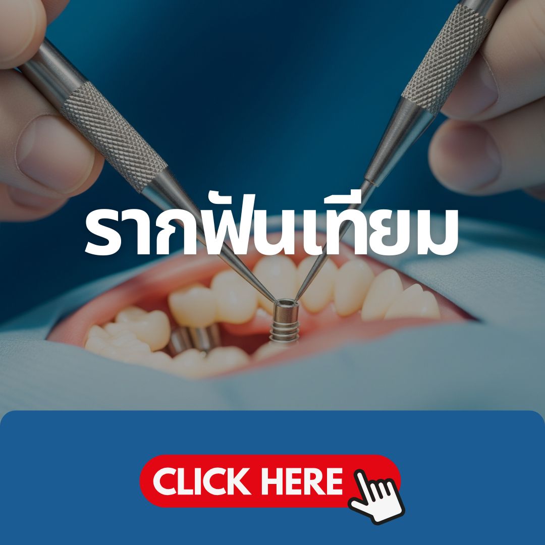 รากฟันเทียม