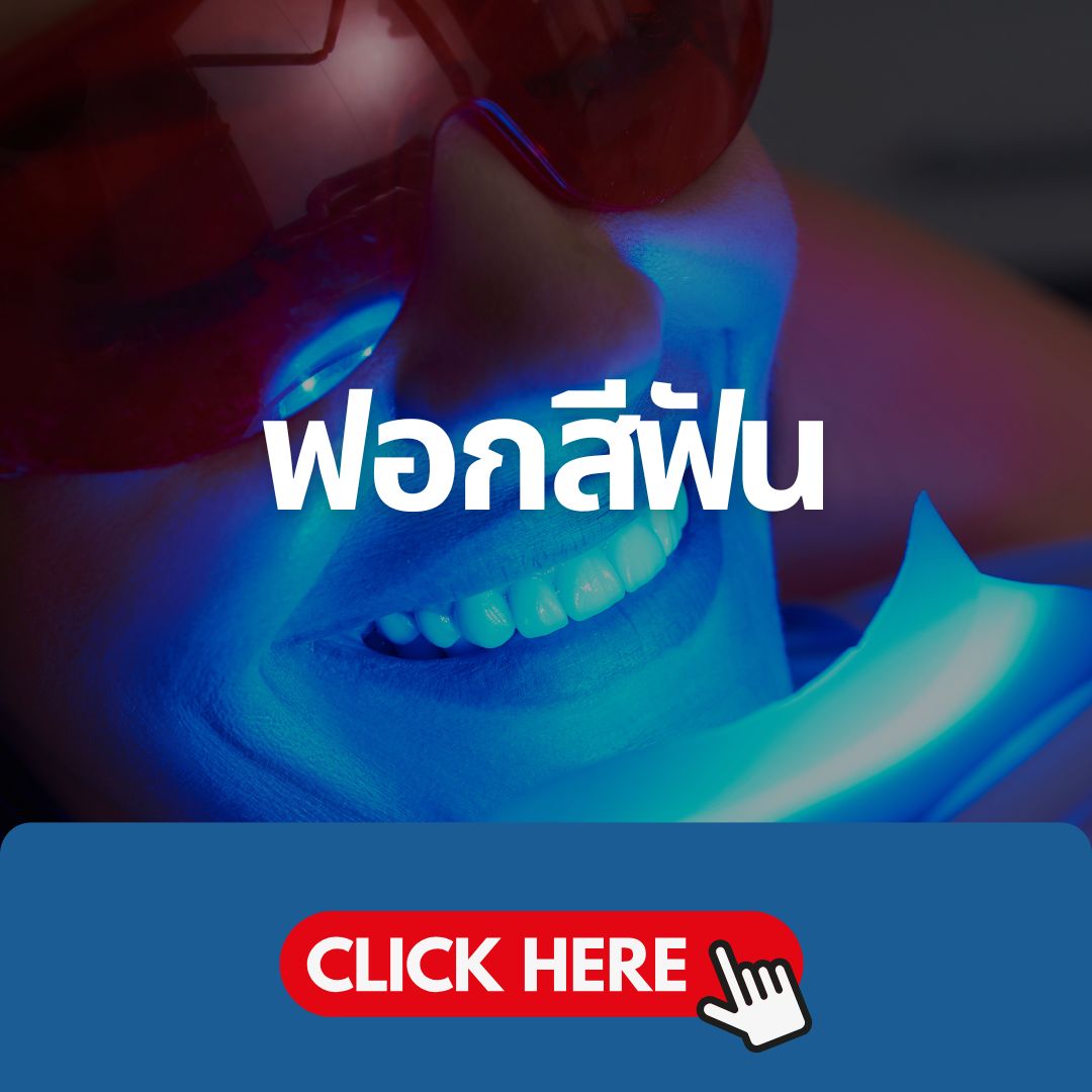 บริการฟอกสีฟัน