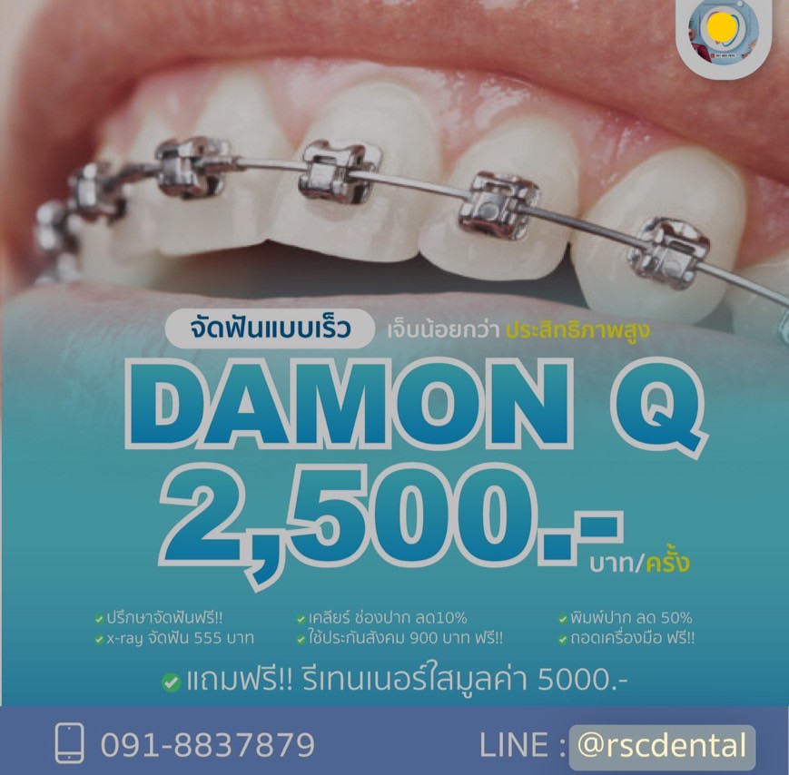 จัดฟัน DamonQ RSC Dental Clinic หน้ารามฯ