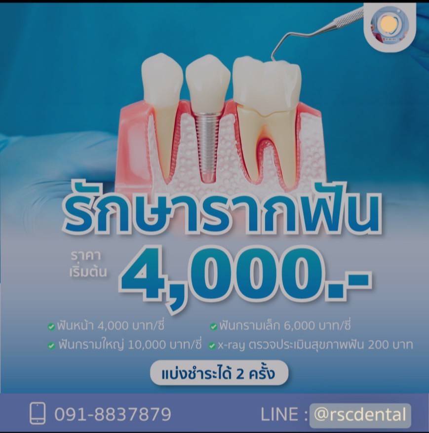 รักษารากฟัน RSC Dental Clinic หน้ารามฯ
